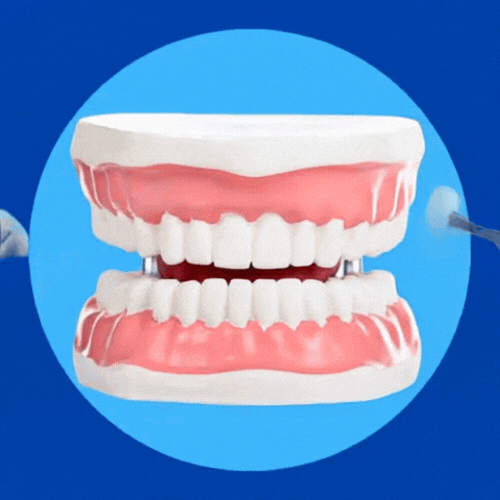 Deep Teeth Cleaning