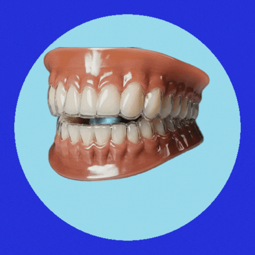 Invisalign